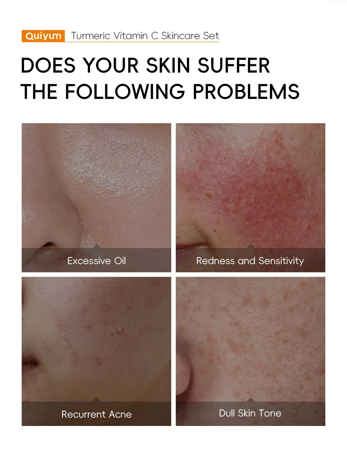 Turmeric Vitamin C Skincare Set Turmeric Facial Acne Cleansing Cream Fade Dark Spots Turmeric Serum Anti-Aging Skin Moisturizing